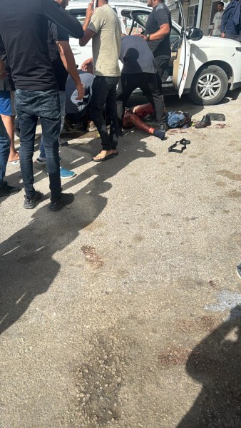 إصابة خطيرة لخمسيني في حادثة عنف برهط